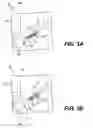 Fig. 04 - TISSUE SPREADER FOR ACCESSING PAPILLA, AND RELATED METHODS OF USE