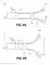 Fig. 05 - TISSUE SPREADER FOR ACCESSING PAPILLA, AND RELATED METHODS OF USE
