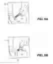 Fig. 06 - TISSUE SPREADER FOR ACCESSING PAPILLA, AND RELATED METHODS OF USE