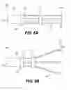 Fig. 07 - TISSUE SPREADER FOR ACCESSING PAPILLA, AND RELATED METHODS OF USE