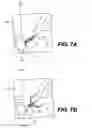 Fig. 08 - TISSUE SPREADER FOR ACCESSING PAPILLA, AND RELATED METHODS OF USE