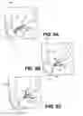 Fig. 10 - TISSUE SPREADER FOR ACCESSING PAPILLA, AND RELATED METHODS OF USE