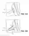 Fig. 12 - TISSUE SPREADER FOR ACCESSING PAPILLA, AND RELATED METHODS OF USE