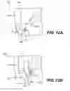 Fig. 13 - TISSUE SPREADER FOR ACCESSING PAPILLA, AND RELATED METHODS OF USE