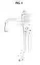 Fig. 02 - Bending angle adjustment mechanism for endoscope