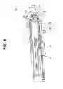 Fig. 07 - Bending angle adjustment mechanism for endoscope