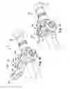 Fig. 10 - Endoscopic sheath assembly