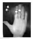 Fig. 01 - OBJECTIVE NON-INVASIVE METHOD FOR QUANTIFYING DEGREE OF ITCH USING PSYCHOPHYSIOLOGICAL MEASURES