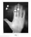 Fig. 02 - OBJECTIVE NON-INVASIVE METHOD FOR QUANTIFYING DEGREE OF ITCH USING PSYCHOPHYSIOLOGICAL MEASURES