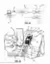 Fig. 02 - Catheter Placement Detection System and Method for Surgical Procedures