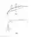 Fig. 02 - Tip extension for difficult to calibrate handpiece