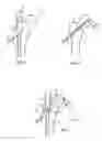 Fig. 04 - METHOD FOR VISUAL ASSISTANCE WHEN FIXING AN IMPLANT, AND TARGET APPARATUS