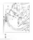 Fig. 08 - Methods and apparatuses for fluoro-less or near fluoro-less percutaneous surgery access