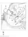 Fig. 09 - Methods and apparatuses for fluoro-less or near fluoro-less percutaneous surgery access