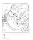 Fig. 11 - Methods and apparatuses for fluoro-less or near fluoro-less percutaneous surgery access