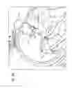 Fig. 08 - Methods and apparatuses for fluoro-less or near fluoro-less percutaneous surgery access