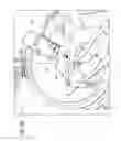 Fig. 11 - Methods and apparatuses for fluoro-less or near fluoro-less percutaneous surgery access
