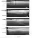 Fig. 02 - Xerostomia Markers