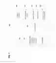 Fig. 08 - Clinical fitting assistance using software analysis of stimuli
