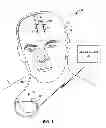Fig. 02 - Patient state determination based on one or more spectral characteristics of a bioelectrical brain signal