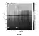 Fig. 05 - Patient state determination based on one or more spectral characteristics of a bioelectrical brain signal