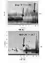 Fig. 06 - Patient state determination based on one or more spectral characteristics of a bioelectrical brain signal