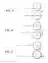 Fig. 15 - Soft tissue coring biopsy devices and methods