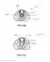 Fig. 76 - Safety blood collection assembly with indicator