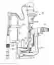 Fig. 01 - Tear duct resistance measuring system