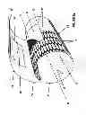 Fig. 04 - Normothermic maintenance system and method