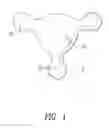 Fig. 02 - MASSAGE DEVICE