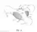 Fig. 04 - MASSAGE DEVICE