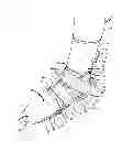 Fig. 01 - Toe Walker Orthosis