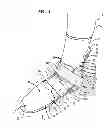 Fig. 02 - Toe Walker Orthosis