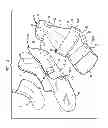 Fig. 04 - Toe Walker Orthosis