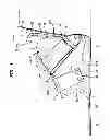 Fig. 05 - Toe Walker Orthosis