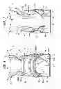 Fig. 07 - Toe Walker Orthosis