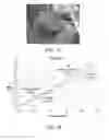 Fig. 08 - System and method for blood filtering and/or treatment