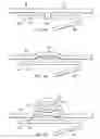 Fig. 07 - Anchors with biodegradable constraints