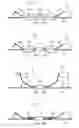 Fig. 08 - Anchors with biodegradable constraints