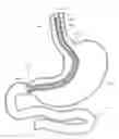 Fig. 01 - METHODS FOR TOPOSCOPIC SLEEVE DELIVERY