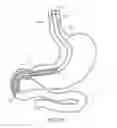 Fig. 08 - METHODS FOR TOPOSCOPIC SLEEVE DELIVERY