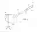 Fig. 10 - METHODS FOR TOPOSCOPIC SLEEVE DELIVERY