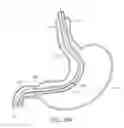 Fig. 37 - METHODS FOR TOPOSCOPIC SLEEVE DELIVERY