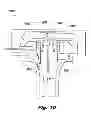 Fig. 09 - System and method for improved gas recirculation in surgical trocars with pneumatic sealing