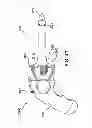 Fig. 40 - System and method for improved gas recirculation in surgical trocars with pneumatic sealing