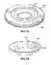 Fig. 49 - System and method for improved gas recirculation in surgical trocars with pneumatic sealing