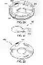 Fig. 52 - System and method for improved gas recirculation in surgical trocars with pneumatic sealing