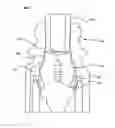 Fig. 01 - Piston for a needleless valve system