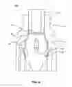 Fig. 05 - Piston for a needleless valve system